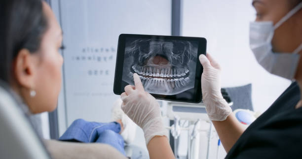 Licensed Tooth Extraction service in Sampson County County, NC - Smile Center Dentistry